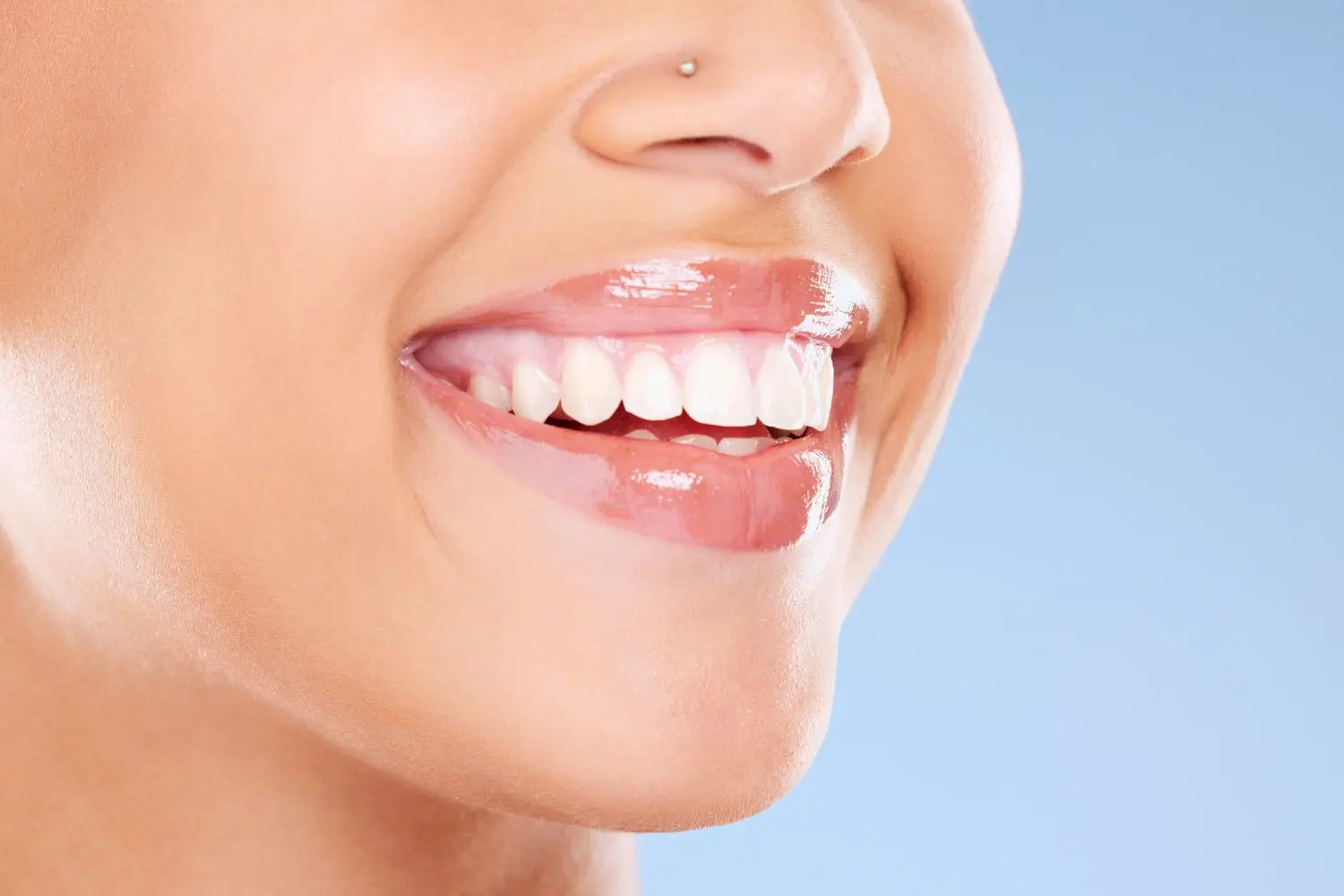 Professionelles Bleaching - Praxis Videntist